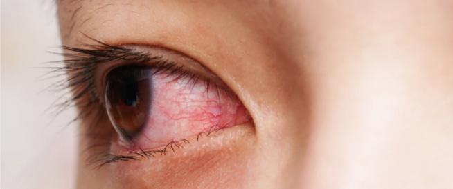 สาเหตุของการตาบอด: นี่คือรายการโดยละเอียด - WebTeb