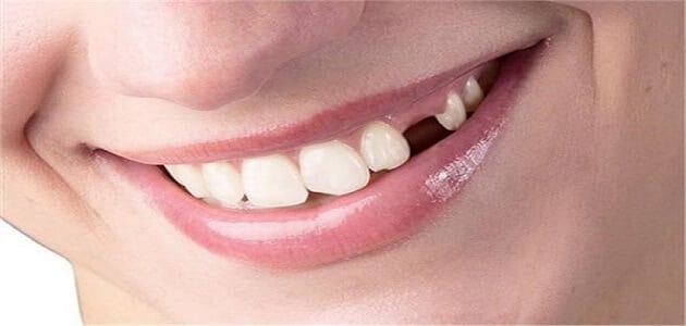 دانت میں درد اور اس کی حرکت کے بارے میں خواب کی تعبیر