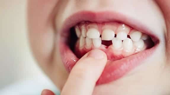 Ερμηνεία ενός ονείρου για ένα δόντι που πέφτει χωρίς πόνο
