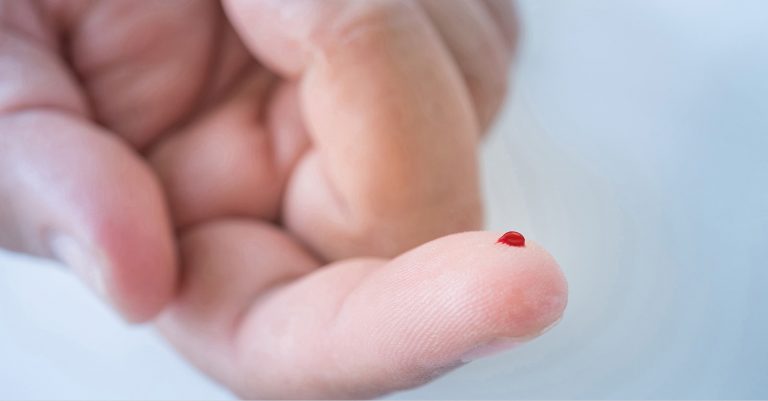 نزول الدم من الاصبع في المنام