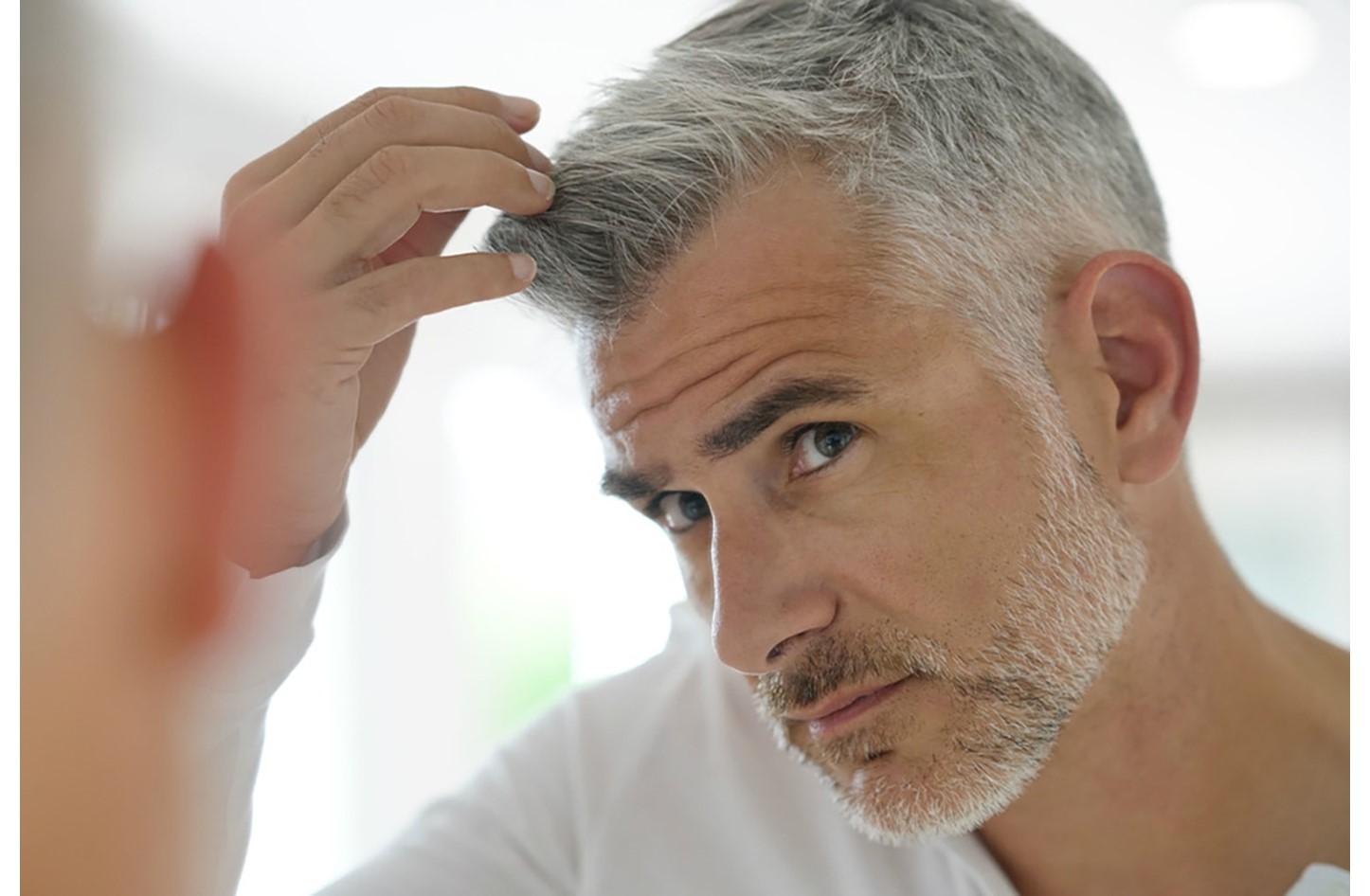 Մազերի աճ ճաղատ գլխի վրա