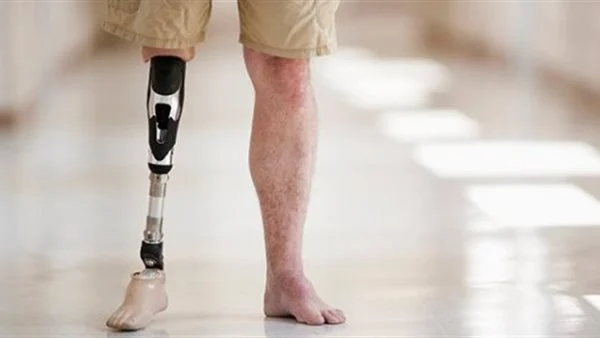 قطع رجل الزوج في المنام