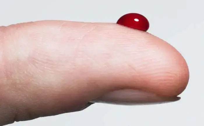 Sognu di sangue sanguinante