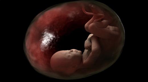การตีความของอิบนุ สิรินทร์ เกี่ยวกับความฝันของหญิงตั้งครรภ์ที่จะทำแท้งทารกในครรภ์