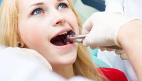 Aprenda a interpretação de um sonho sobre extração de dente com o médico
