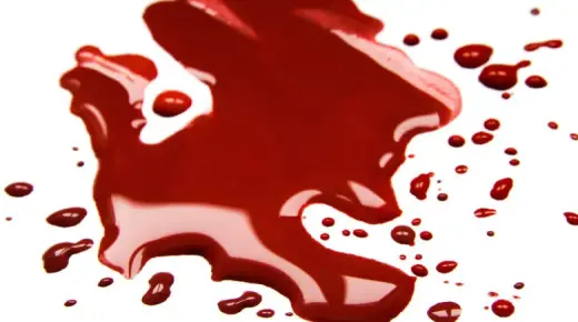 Научете го толкувањето на сонот за крв што излегува од вагината на човекот од Ибн Сирин