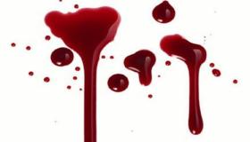 ما هو تفسير حلم نزول الدم من المهبل لابن سيرين؟