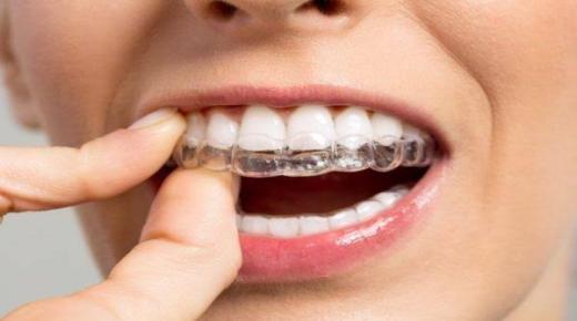Tolkning av en dröm om ortodonti som faller ut för ensamstående kvinnor