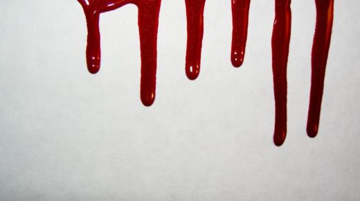 تفسير شرب الدم في المنام لابن سيرين وابن شاهين